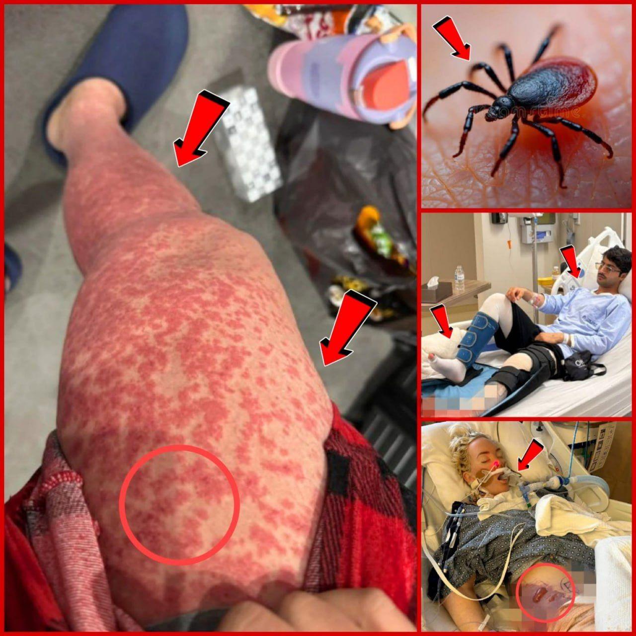 346871706_611014397648022_6405374181272223434_n-326x245